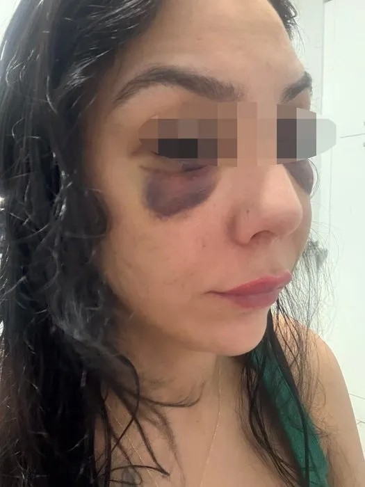 Konya'da kadına şiddet! Pes dedirten olay: Şikayette bulunacak mı?